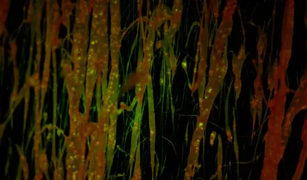 nanofibers of glycine spun with polycaprolactone