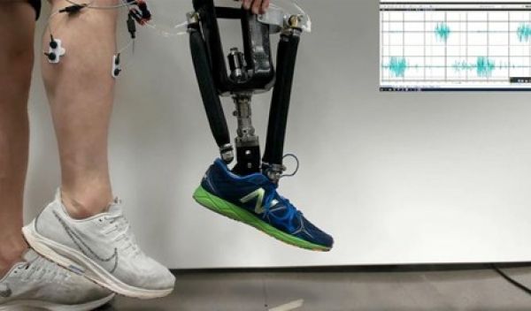 Sensors capture calf muscles' electrical activity and tell a prosthesis which artificial muscle to flex.