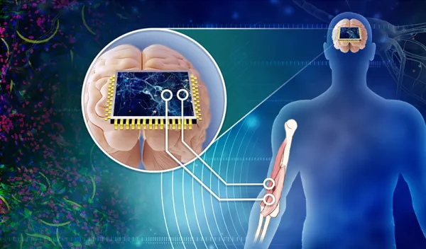 3D neural network, stroke, neurorestoration, intelligence, self-correction, Brain organoids, Stretchable electronics, Artificial intelligence, Machine learning