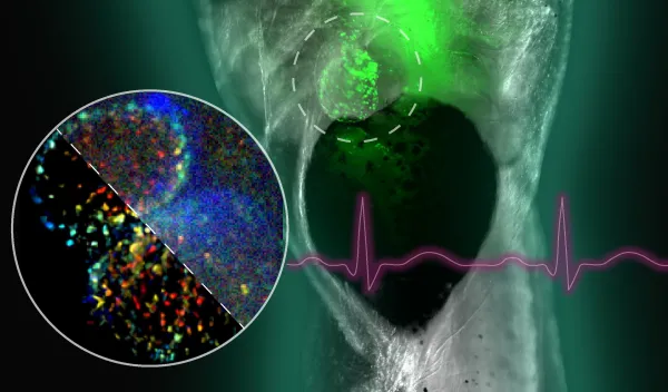 A composite of images related to a new algorithm developed by NSF-funded researchers that will enable better diagnosis of cardiovascular disease.