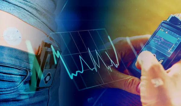 AI Delivers smart glucose predictions