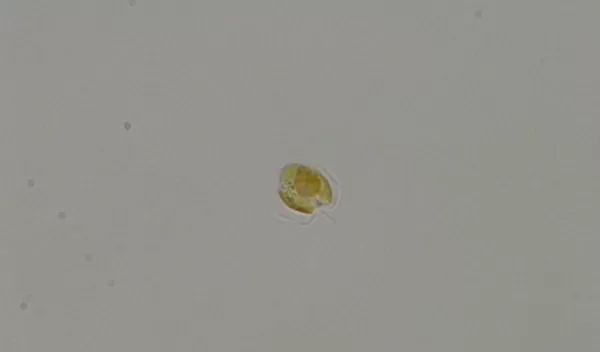 A single golden alga on a slide. The alga has two flagella and a third appendage known as a haptonema.