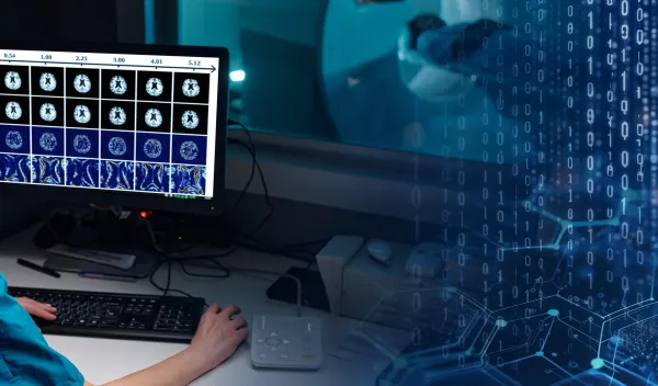 AI and Brain Research