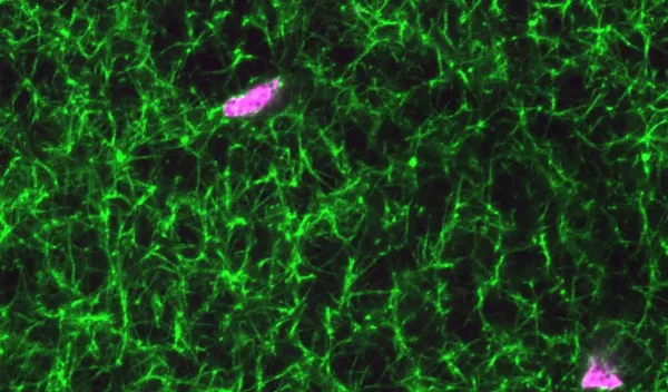 A microscopic image of a blood clot containing synthetic platelet-like-particles. Fibrin is shown in green and the synthetic platelets are pink.