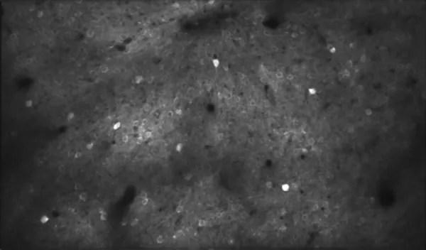 A grayscale image shows several neurons being activated in the mouse auditory cortex during learning of an auditory discrimination task.