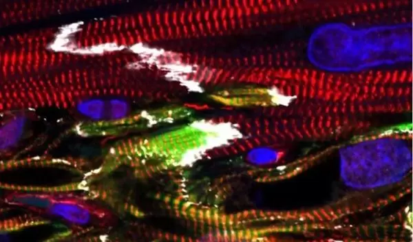 Mixing endothelial cells with heart muscle addresses major challenges of bringing treatments to the clinic.