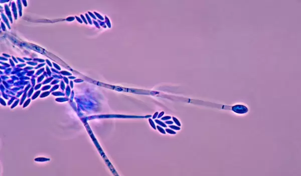 Photomicrograph of Fusarium verticillioides, a relative of the F. acuminatum species used in the study.