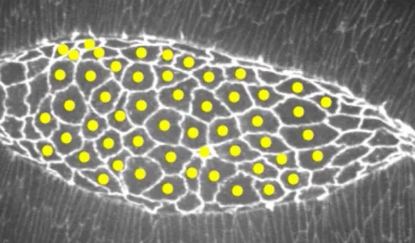 a dorsal closure stage embryo