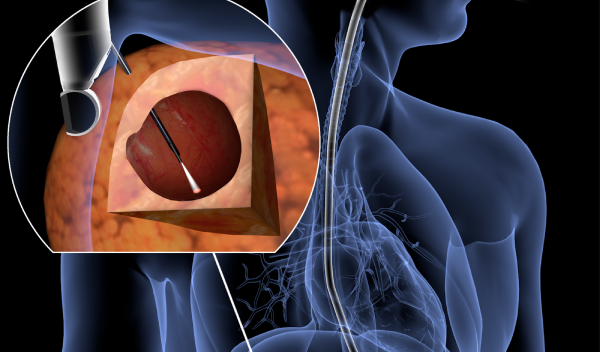 Light-based diagnostic technique