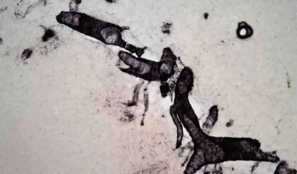 Amyloid beta deposits in the blood vessels in the brain of a 58-year-old female chimpanzee.