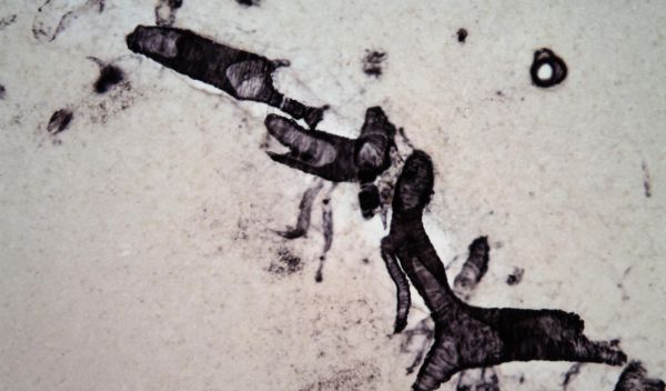 Amyloid beta deposits in the blood vessels in the brain of a 58-year-old female chimpanzee.