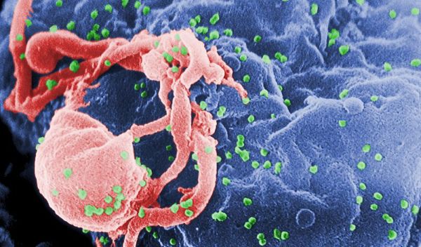 Scanning electron micrograph of HIV-1 budding from a cultured cell.