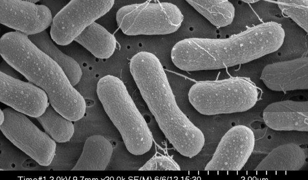 micrograph showing methane-eating bacteria