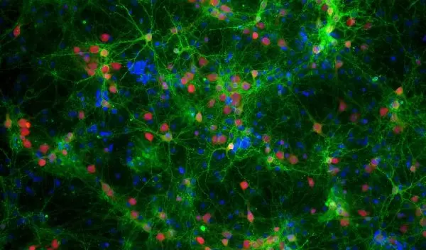 Neurons of a mouse brain