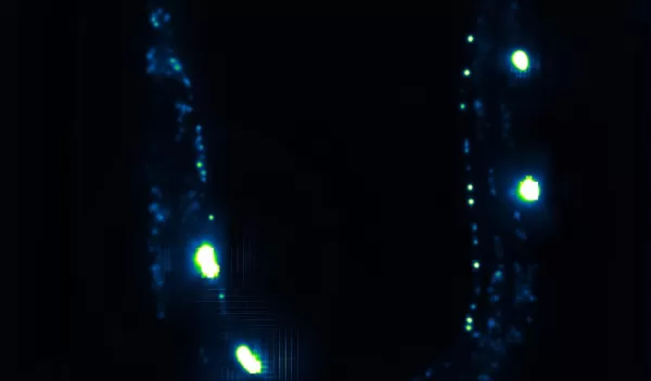 The whole nervous system of a worm.