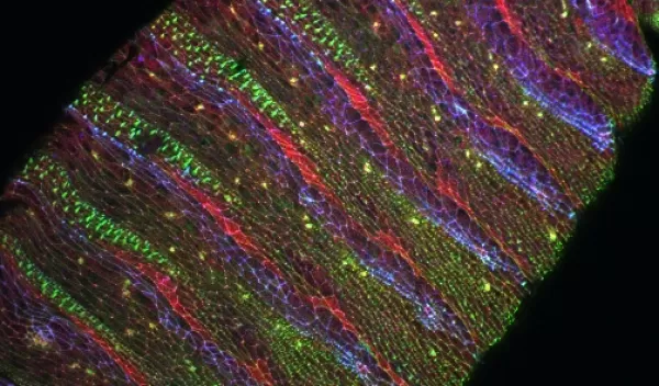 fruit fly's Abl gene