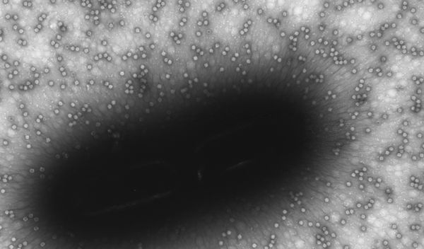 bacteria infected by a virus