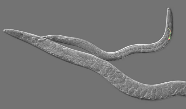 C. elegans adult hermaphrodite (lower) and male (upper), with two fluorescing neurons