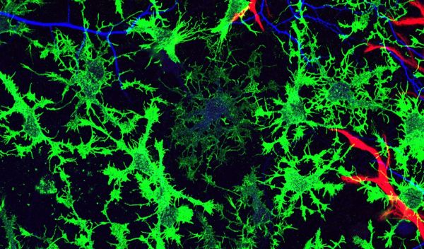 glial cells in a mouse brain