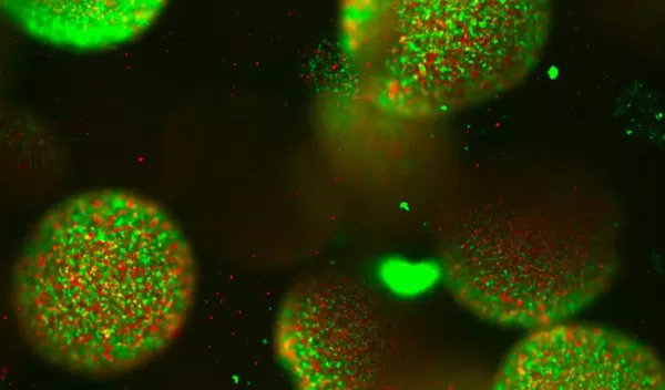 different species of bacteria