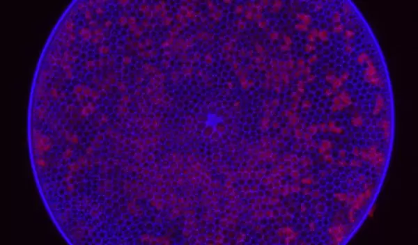 This diatom cell from the Gulf of Mexico is stained to show newly formed cell walls (blue).