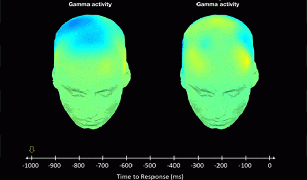 image showing insight-related brain activity