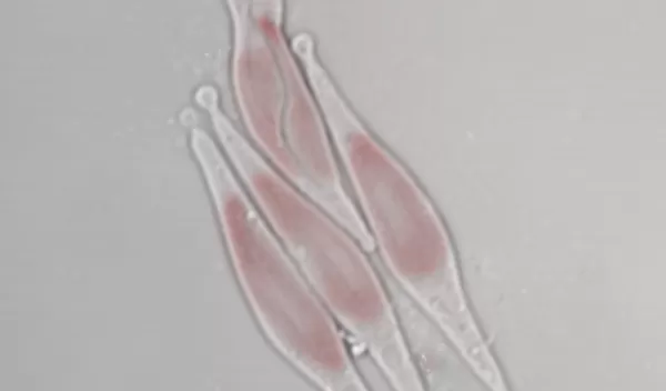 Phaeodactylum tricornutum diatoms