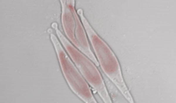 Phaeodactylum tricornutum diatoms