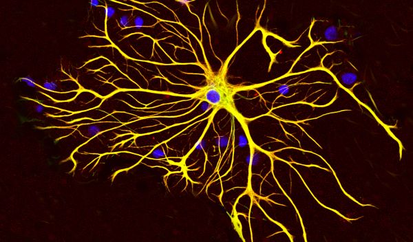 astrocytes