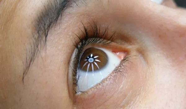 eye
