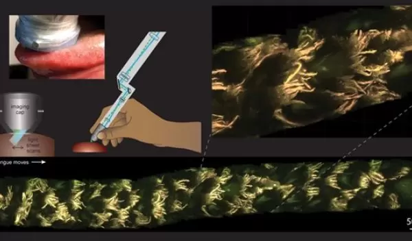 MediSCAPE imaging of the living human tongue