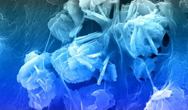 A mineralized collagen scaffold showing the mineral crystals and collagen fibers.