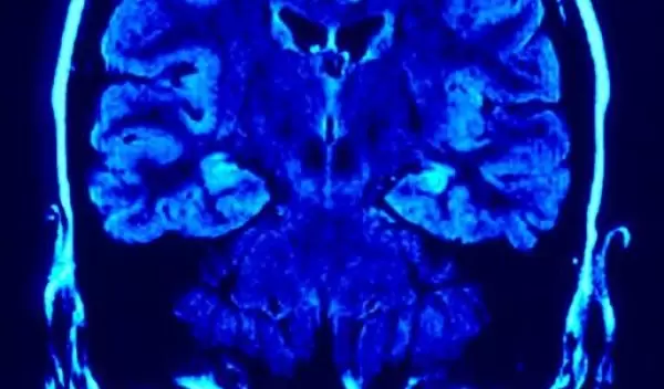 Unlocking The Secrets And Powers Of The Brain NSF National Science unlocking-the-secrets-and-powers-of-the-brain-nsf-national-science