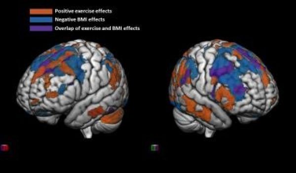 image showing positive effects of physical activity (in orange) and negative effects of BMI (in blue)