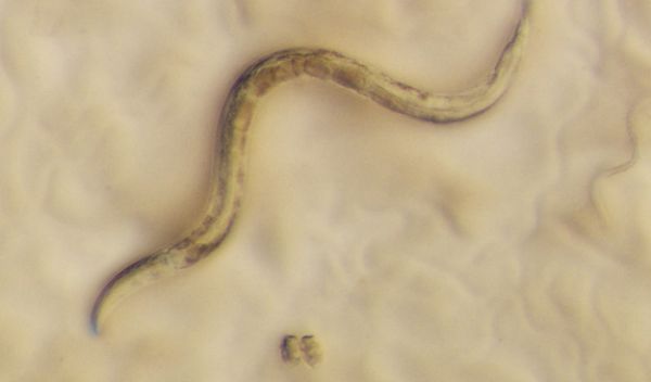 Photomicrograph of the roundworm Caenorhabditis elegans.