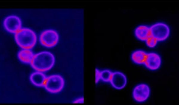 Aneuploid yeast cells