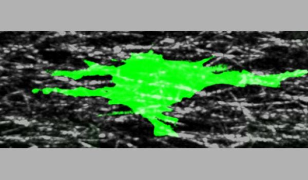 Scientists are discovering clues to a mystery about cell movement.