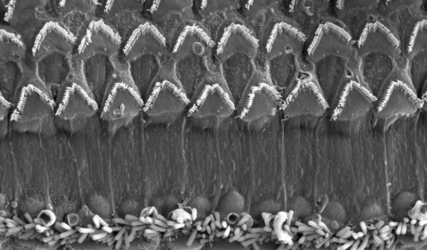 a top-down view of the cochlea