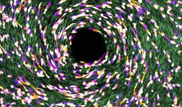 collagen fibers and cancer cells