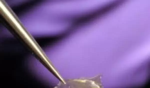 Scientists at the Johns Hopkins Univeristy produced a sample of the modified collagen.