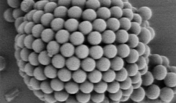 electron microscope image of a colloidosome