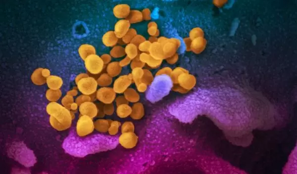 SARS-CoV-2 (yellow)âalso known as 2019-nCoV