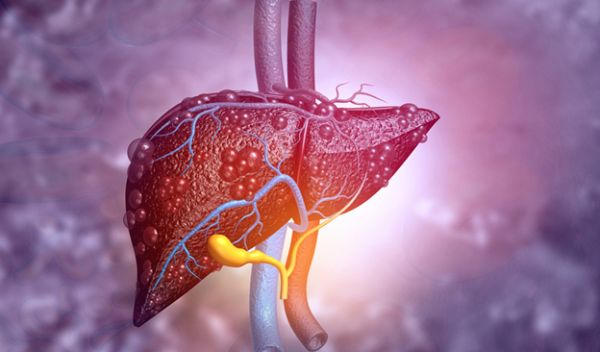 Scientists are developing a new way to detect fatty liver disease.