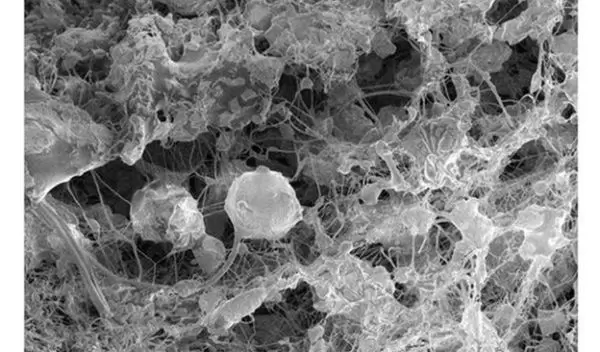 Cross-section view of electrospun tubes