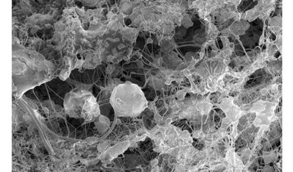 Cross-section view of electrospun tubes