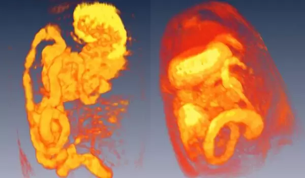 Three-dimensional reconstructions of magnetic resonance images of the rat gastro-intestinal tract.
