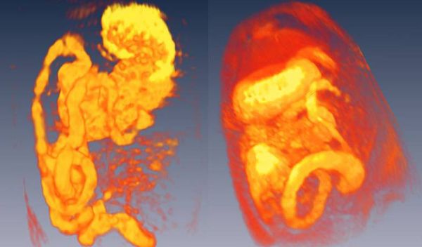 Three-dimensional reconstructions of magnetic resonance images of the rat gastro-intestinal tract.