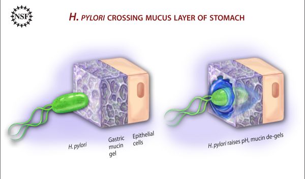 Illustration showing H. pylori liquefying stomach mucin to cross over to the epithelium cells.