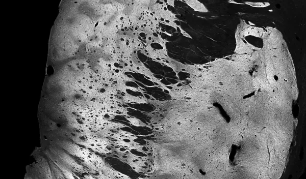 photo of a section from a human brain