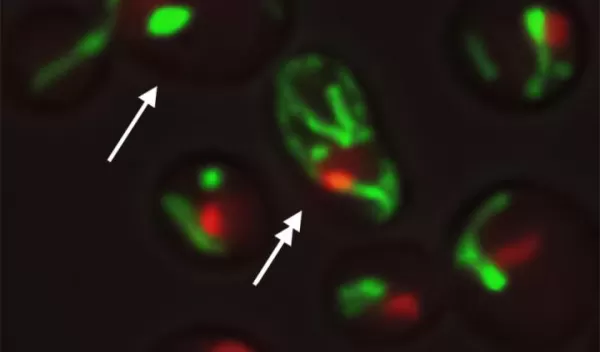 yeast cells with the same DNA